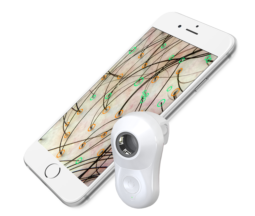 TrikoScope Device